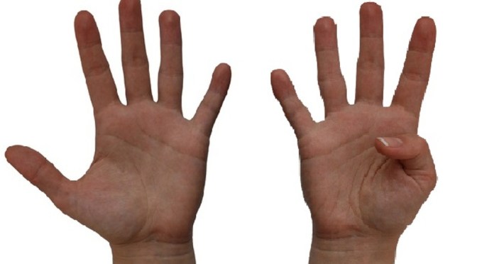 Mudah dan Murah, Manfaatkan Jari Kelingking untuk Kesehatan Anda