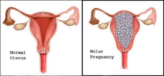 WhatsApp Image 2017-07-06 at 13.06.38